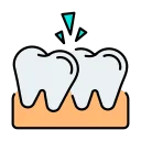 Braces and Aligners in Banashankari