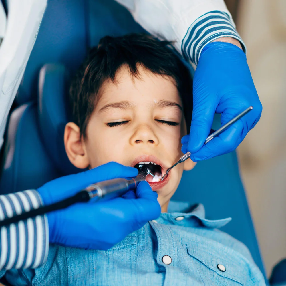 Pediatric Dentistry in Banashankari
