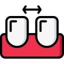 Braces and Aligners in Banashankari